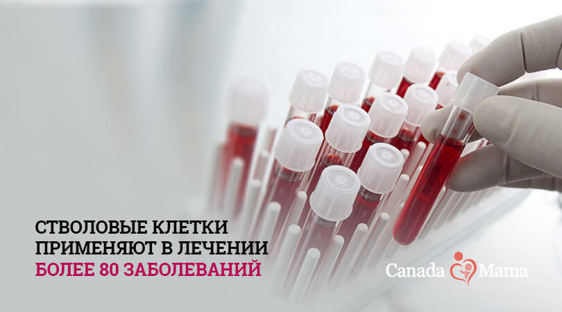 Преимущества сбора стволовых клеток